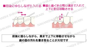 フロスの使い方　前後・上下に動かして使う